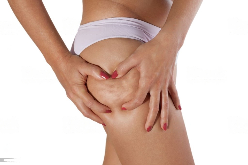 Lipocavitation Radiofréquences Innova Skin Belcodène